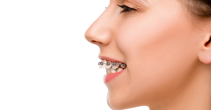 Orthodontics